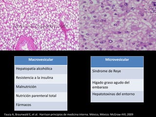 Macrovesicular
Hepatopatía alcohólica
Resistencia a la insulina
Malnutrición
Nutrición parenteral total
Fármacos
Microvesicular
Síndrome de Reye
Hígado graso agudo del
embarazo
Hepatotoxinas del entorno
Faucy A, Braunwald E, et al. Harrison principios de medicina interna. México, México: McGraw-Hill; 2009
 