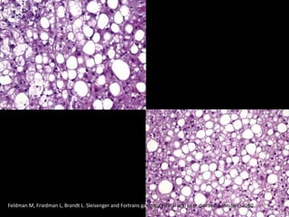 Feldman M, Friedman L, Brandt L. Sleisenger and Fortrans gastrointestinal and liver disease. Saunders; 2010
 