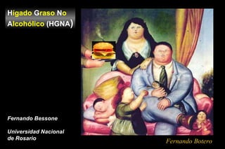 H ígado  G raso  N o  A lcohólico  (HGNA ) Fernando Bessone Universidad Nacional  de Rosario Fernando Botero 