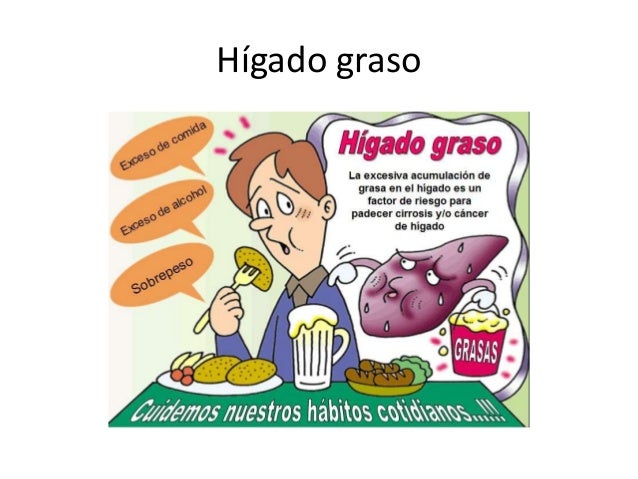 Esteatosis hepatica Esteatosis hepatica
