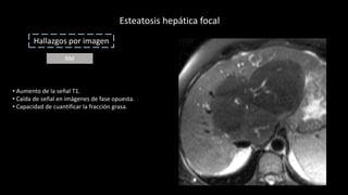 Esteatosis Hep tica pptx esteatosis-hep-tica-pptx