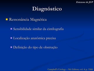 Diagnóstico Ressonância Magnética Sensibilidade similar da cintilografia Localização anatômica precisa Definição do tipo de obstrução  Estenose de JUP Campbell’s Urology – 9th Edition; vol. 4; p. 3368. 