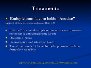 Tratamento Endopielotomia com balão "Acucise”  (Applied Medical Technologies, Laguna Hilis, CA) Balão de Baixa Pressão acoplado com uma alça eletrocortante monopolar de aproximadamente 3,0 cm  Dilatação e Incisão  Fluoroscopia e um Cistoscópio básico  Taxa de Sucesso de 79% em obstruções primárias e 94% em obstruções secundárias   http://www.uronline.unifesp.br/uronline/ed1000/tratamento.htm  