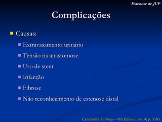Complicações Causas: Extravasamento urinário Tensão na anastomose Uso de stent Infecção Fibrose Não reconhecimento de estenose distal Campbell’s Urology – 9th Edition; vol. 4; p. 3380. Estenose de JUP 
