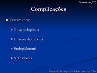 Complicações Tratamento: Nova pieloplastia Ureterocalicostomia Endopielotomia Nefrectomia Campbell’s Urology – 9th Edition; vol. 4; p. 3380. Estenose de JUP 
