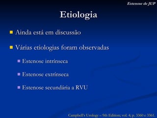 Etiologia Ainda está em discussão Várias etiologias foram observadas Estenose intrínseca Estenose extrínseca Estenose secundária a RVU Estenose de JUP Campbell’s Urology – 9th Edition; vol. 4; p. 3360 e 3361. 