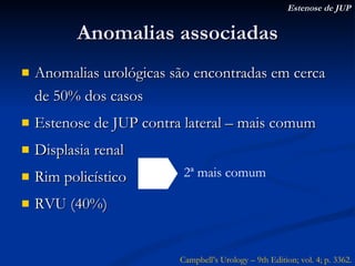 Anomalias associadas Anomalias urológicas são encontradas em cerca de 50% dos casos Estenose de JUP contra lateral – mais comum Displasia renal Rim policístico RVU (40%) Estenose de JUP 2ª mais comum Campbell’s Urology – 9th Edition; vol. 4; p. 3362. 