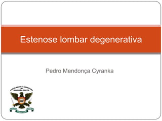 Pedro Mendonça Cyranka
Estenose lombar degenerativa
 