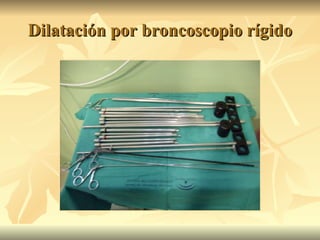 Dilatación por broncoscopio rígido 