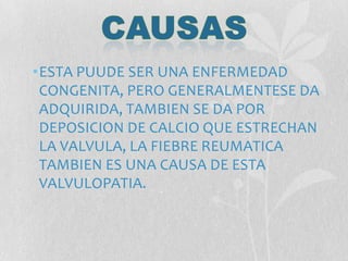 •ESTA PUUDE SER UNA ENFERMEDAD
CONGENITA, PERO GENERALMENTESE DA
ADQUIRIDA, TAMBIEN SE DA POR
DEPOSICION DE CALCIO QUE ESTRECHAN
LA VALVULA, LA FIEBRE REUMATICA
TAMBIEN ES UNA CAUSA DE ESTA
VALVULOPATIA.
 