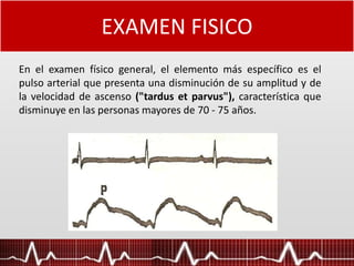 EXAMEN FISICO
En el examen físico general, el elemento más específico es el
pulso arterial que presenta una disminución de su amplitud y de
la velocidad de ascenso ("tardus et parvus"), característica que
disminuye en las personas mayores de 70 - 75 años.
 