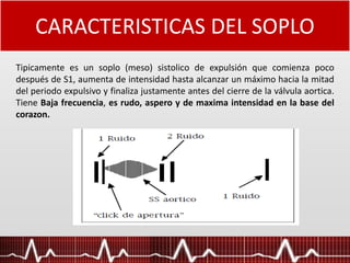 CARACTERISTICAS DEL SOPLO
Tipicamente es un soplo (meso) sistolico de expulsión que comienza poco
después de S1, aumenta de intensidad hasta alcanzar un máximo hacia la mitad
del periodo expulsivo y finaliza justamente antes del cierre de la válvula aortica.
Tiene Baja frecuencia, es rudo, aspero y de maxima intensidad en la base del
corazon.
 
