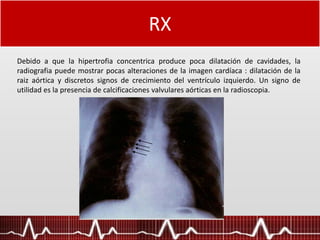 RX
Debido a que la hipertrofia concentrica produce poca dilatación de cavidades, la
radiografia puede mostrar pocas alteraciones de la imagen cardíaca : dilatación de la
raiz aórtica y discretos signos de crecimiento del ventrículo izquierdo. Un signo de
utilidad es la presencia de calcificaciones valvulares aórticas en la radioscopia.
 