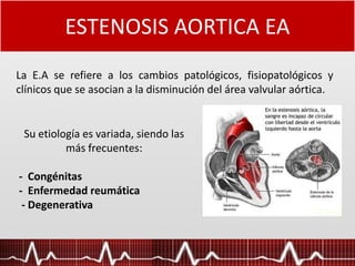 ESTENOSIS AORTICA EA
La E.A se refiere a los cambios patológicos, fisiopatológicos y
clínicos que se asocian a la disminución del área valvular aórtica.
Su etiología es variada, siendo las
más frecuentes:
- Congénitas
- Enfermedad reumática
- Degenerativa
 