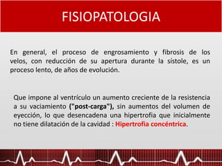 FISIOPATOLOGIA
En general, el proceso de engrosamiento y fibrosis de los
velos, con reducción de su apertura durante la sístole, es un
proceso lento, de años de evolución.
Que impone al ventrículo un aumento creciente de la resistencia
a su vaciamiento ("post-carga"), sin aumentos del volumen de
eyección, lo que desencadena una hipertrofia que inicialmente
no tiene dilatación de la cavidad : Hipertrofia concéntrica.
 