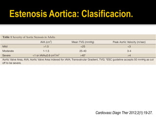 Cardiovasc Diagn Ther 2012;2(1):19-27.
 