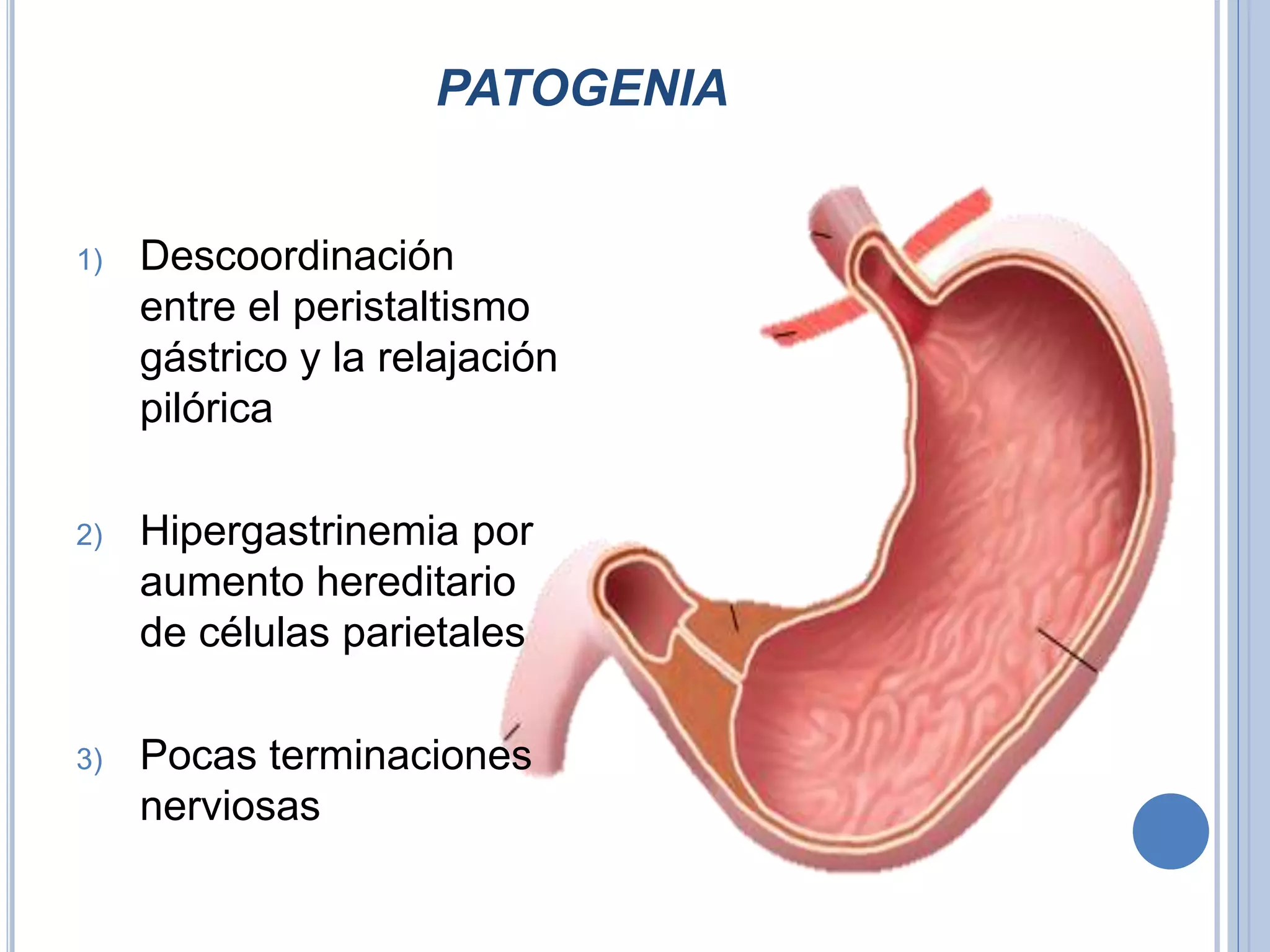 Estenosis hipertrófica del píloro | PPTX | Digestive Disorders ...