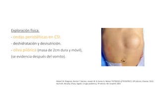 Estenosis hipertrofica del piloro | PPTX