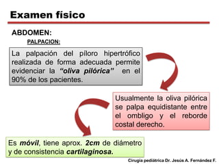 Estenosis hipertrofica de piloro | PPTX