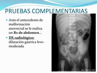 Estenosis hipertrofica piloro | PPTX