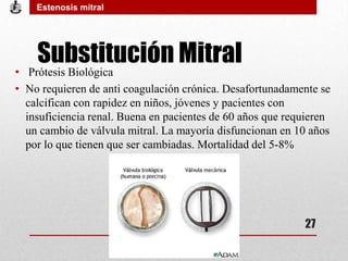 Substitución Mitral
• Prótesis Biológica
• No requieren de anti coagulación crónica. Desafortunadamente se
calcifican con rapidez en niños, jóvenes y pacientes con
insuficiencia renal. Buena en pacientes de 60 años que requieren
un cambio de válvula mitral. La mayoría disfuncionan en 10 años
por lo que tienen que ser cambiadas. Mortalidad del 5-8%
Estenosis mitral
27
 
