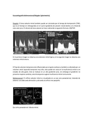 Ecocardiografía bidimensional/Doppler (planimetría)

Doppler: El área valvular mitral también puede ser calculada por el tiempo de hemipresión (THP),
que es el tiempo en milisegundos en el cual el gradiente de presión inicial declina a la mitad de
este valor pico. El cálculo del área valvular se hace realizando la siguiente formula: 220/THP.

En la primera imagen se observa una estenosis mitral ligera; en la segunda imagen se observa una
estenosis mitral severa.

El flujo de volumen temprano esta influenciado por el gasto cardiaco y también es afectado por un
volumen atrial izquierdo temprano muy alto, esto puede ser visto en la insufi ciencia mitral o en
estados de alto gasto. Esto se traduce en un alto gradiente pico, sin embargo el gradiente no
presenta mayores cambios; esta discrepancia sugiere insuficiencia mitral concurrente.
Bidimensional: El orificio valvular mitral es visualizado en un eje coro paraesternal, tratando de
obtener una adecuada alineación y ubicando el orificio mas pequeño.

Eje corto paraesternal. Válvula mitral.

 