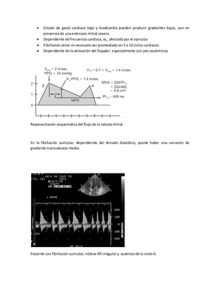 Estado de gasto cardiaco bajo y bradicardia pueden producir gradientes bajos, aun en
presencia de una estenosis mitral severa
Dependiente de frecuencia cardiaca, ej., afectada por el ejercicio
Fibrilación atrial: es necesario ser promediado en 5 a 10 ciclos cardiacos
Dependiente de la alineación del Doppler, especialmente con jets excéntricos

Representación esquemática del flujo de la válvula mitral.

En la fibrilación auricular, dependiendo del llenado diastólico, puede haber una variación de
gradiente transvalvular medio.

Paciente con fibrilación auricular; nótese RR irregular y ausencia de la onda A.

 