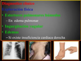 Diagnostico clínico
Exploración física
• Estertores pulmonares húmedos
– En edema pulmonar.

• Ingurgitación yugular
• Edemas
– Si existe insuficiencia cardiaca derecha

 