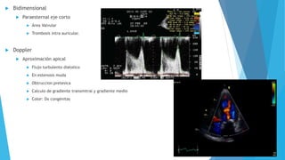  Bidimensional 
 Paraesternal eje corto 
 Área Valvular 
 Trombosis intra auricular. 
 Doppler 
 Aproximación apical 
 Flujo turbulento diatolico 
 En estenosis muda 
 Obtruccion pretesica 
 Calculo de gradiente transmitral y gradiente medio 
 Color: Dx congénitas 
 