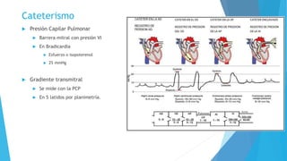 Cateterismo 
 Presión Capilar Pulmonar 
 Barrera mitral con presión VI 
 En Bradicardia 
 Esfuerzo o isopoterenol 
 25 mmHg 
 Gradiente transmitral 
 Se mide con la PCP 
 En 5 latidos por planimetría. 
 