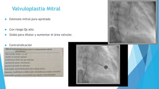 Valvuloplastia Mitral 
 Estenosis mitral pura apretada 
 Con riesgo Qx alto 
 Globo para dilatar y aumentar el área valvular. 
 Contraindicación 
 Calcificación 
 