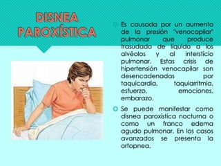  Es causada por un aumento
de la presión "venocapilar"
pulmonar que produce
trasudado de líquido a los
alvéolos y al intersticio
pulmonar. Estas crisis de
hipertensión venocapilar son
desencadenadas por
taquicardia, taquiarritmia,
esfuerzo, emociones,
embarazo.
 Se puede manifestar como
disnea paroxística nocturna o
como un franco edema
agudo pulmonar. En los casos
avanzados se presenta la
ortopnea.
 