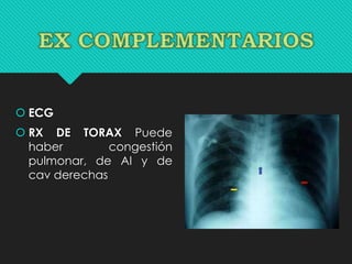  ECG
 RX DE TORAX Puede
haber congestión
pulmonar, de AI y de
cav derechas
 