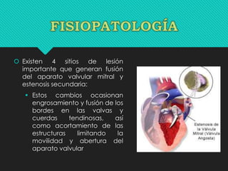  Existen 4 sitios de lesión
importante que generan fusión
del aparato valvular mitral y
estenosis secundaria:
 Estos cambios ocasionan
engrosamiento y fusión de los
bordes en las valvas y
cuerdas tendinosas, así
como acortamiento de las
estructuras limitando la
movilidad y abertura del
aparato valvular
 