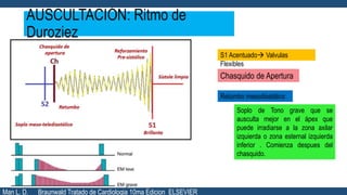AUSCULTACIÓN: Ritmo de
Duroziez
S1 Acentuado Valvulas
Flexibles
Chasquido de Apertura
Retumbo mesodiastólico
Soplo de Tono grave que se
ausculta mejor en el ápex que
puede irradiarse a la zona axilar
izquierda o zona esternal izquierda
inferior . Comienza despues del
chasquido.
Man L. D. Braunwald Tratado de Cardiologia 10ma Edicion ELSEVIER
 