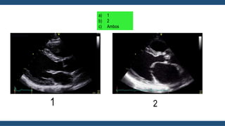 a) 1
b) 2
c) Ambos
1 2
 