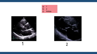 a) 1
b) 2
c) Ambos
1 2
 