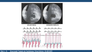 Man L. D. Braunwald Tratado de Cardiologia 10ma Edicion ELSEVIER
 