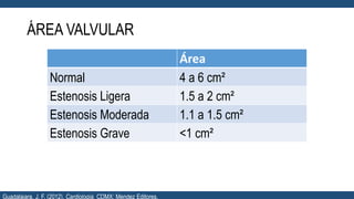 ÁREA VALVULAR
Área
Normal 4 a 6 cm²
Estenosis Ligera 1.5 a 2 cm²
Estenosis Moderada 1.1 a 1.5 cm²
Estenosis Grave <1 cm²
Guadalajara, J. F. (2012). Cardiología. CDMX: Mendez Editores.
 