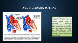 ETIOLOGÍA
. Funcional o
secundaria a un
problema
ventricular
. Primaria u
orgánica la
afección es a nivel
de las válvulas....