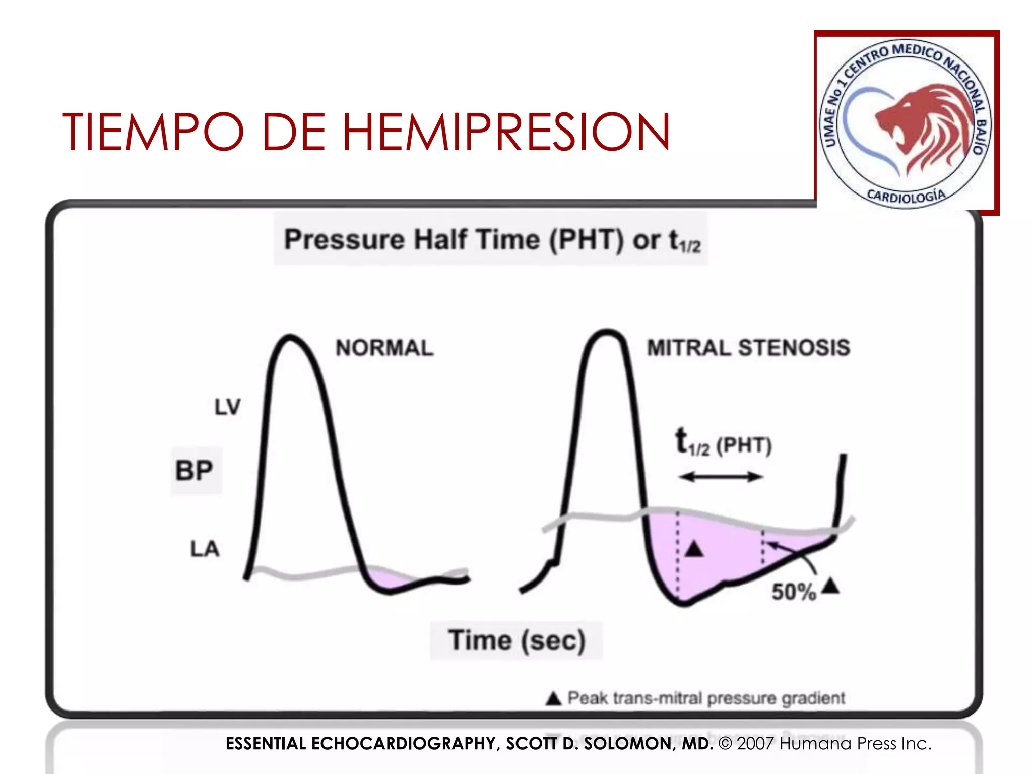 estenosis-mitral-ecocardiografia-pptx