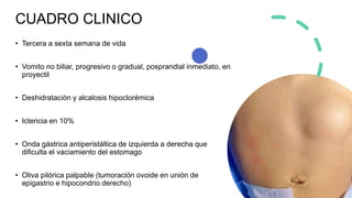 Estenosis Pilorica.pptx