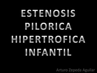 ESTENOSIS PILORICA HIPERTROFICA INFANTIL Arturo Zepeda Aguilar 