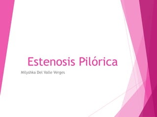 Estenosis Pilórica
Milyshka Del Valle Verges
 