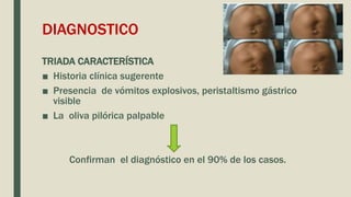 ESTENOSIS PILÓRICA -OBSTRUCCION INTESTINAL.pptx