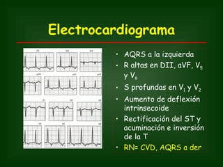 Electrocardiograma
         • AQRS a la izquierda
         • R altas en DII, aVF, V5
           y V6
         • S profundas en V1 y V2
         • Aumento de deflexión
           intrinsecoide
         • Rectificación del ST y
           acuminación e inversión
           de la T
         • RN= CVD, AQRS a der
 