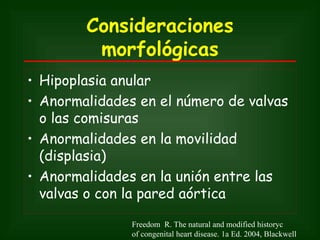 Consideraciones
         morfológicas
• Hipoplasia anular
• Anormalidades en el número de valvas
  o las comisuras
• Anormalidades en la movilidad
  (displasia)
• Anormalidades en la unión entre las
  valvas o con la pared aórtica

               Freedom R. The natural and modified historyc
               of congenital heart disease. 1a Ed. 2004, Blackwell
 