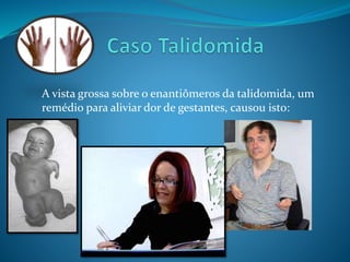 A vista grossa sobre o enantiômeros da talidomida, um 
remédio para aliviar dor de gestantes, causou isto: 
 