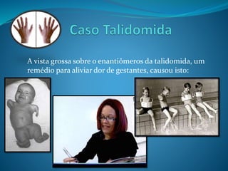 A vista grossa sobre o enantiômeros da talidomida, um 
remédio para aliviar dor de gestantes, causou isto: 
 