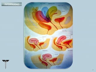 INFERTILIDAD
24
 